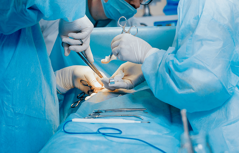 хирургичен метод за уголемяване на пениса